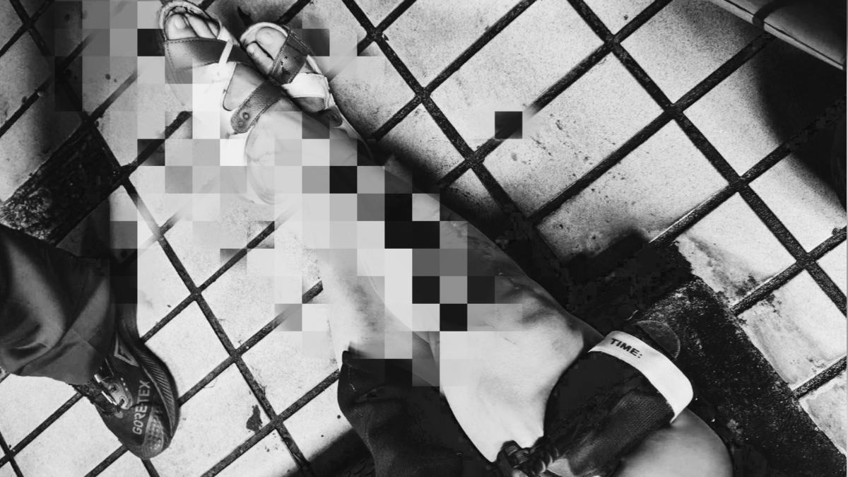 驚魂!基隆女踩破老舊水溝蓋 小腿劃傷「皮開肉綻」濺血
