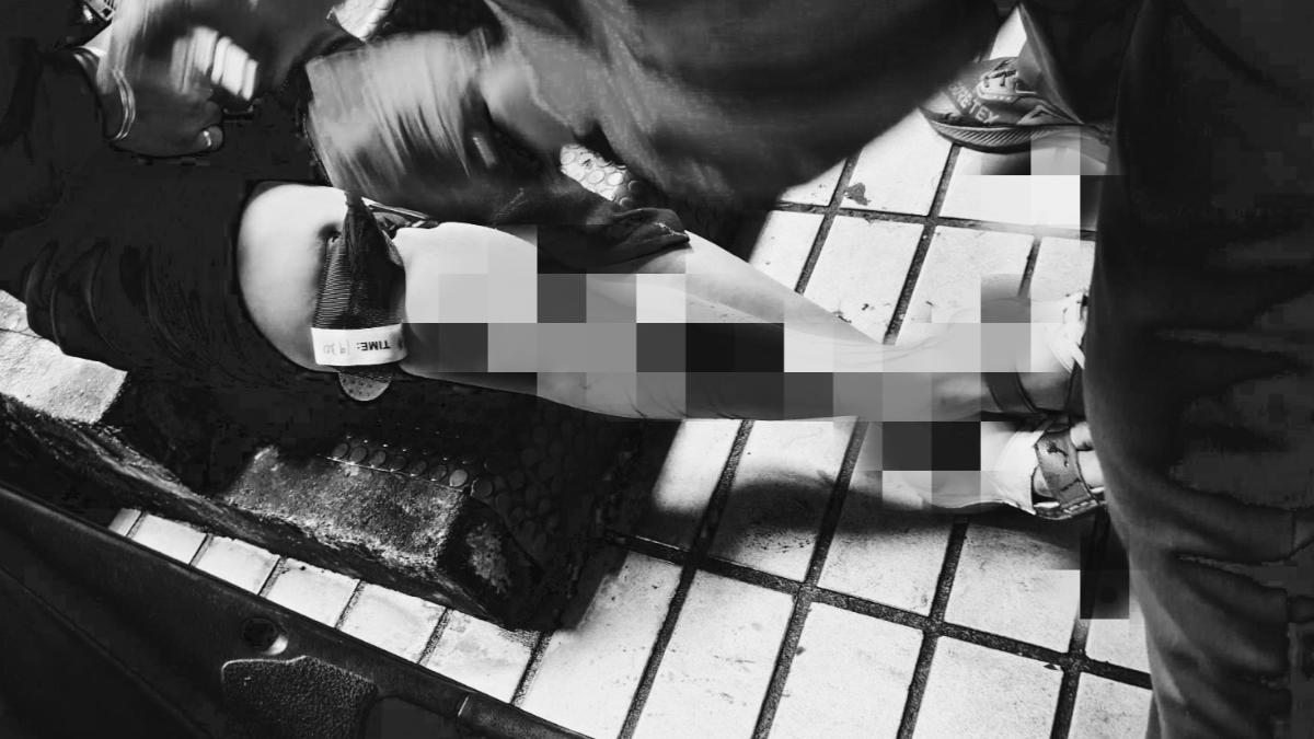 女子遭割傷後,送往醫院縫了30多針。(圖/翻攝自我是基隆人臉書社團)