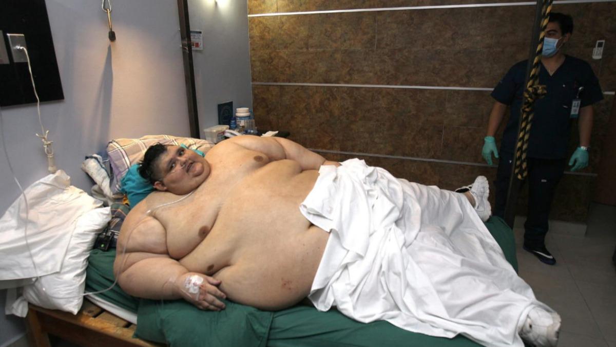 曾重達600公斤!「世界最胖男」腎感染併發症離世享年41歲