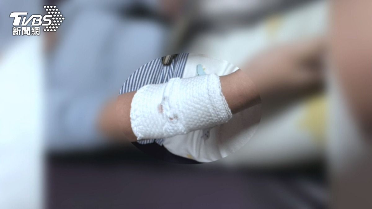 家兔咬傷童手臂　鐵廠老闆怒棄45隻。(圖／TVBS)