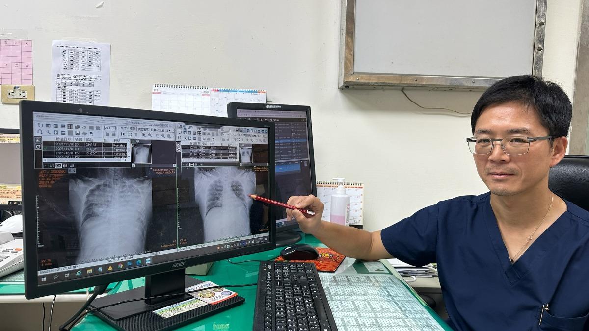 張正一指出，嗆咳本身並不可怕，但若出現瞬間昏迷的症狀，就代表不是單純嗆到。（圖／豐原醫院提供）
