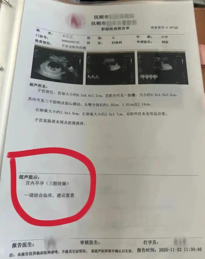 王女士產檢報告，每次多出一胎。（圖／翻攝極目新聞）