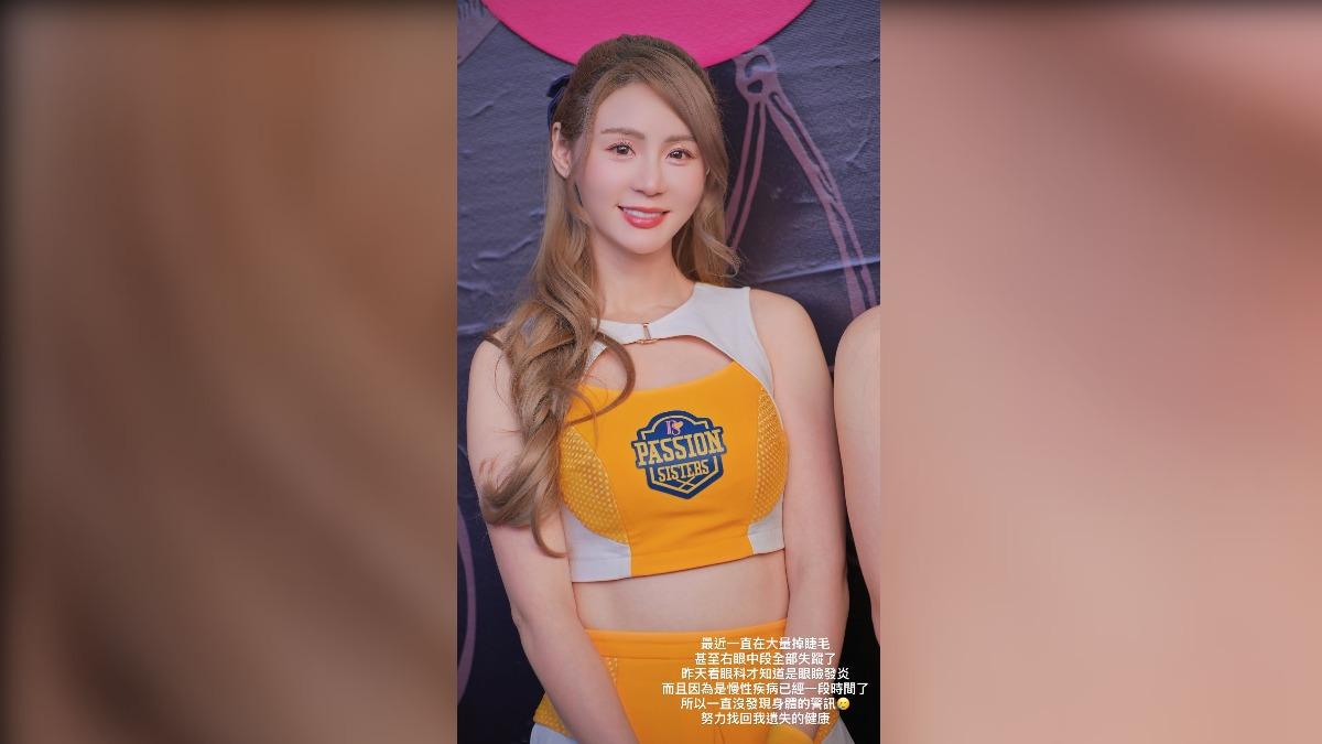中信兄弟啦啦隊短今,6號在限時動態中透露自己右眼中段的睫毛都掉光,就醫後才發現是眼瞼炎。(圖/翻攝IG sammie_923)