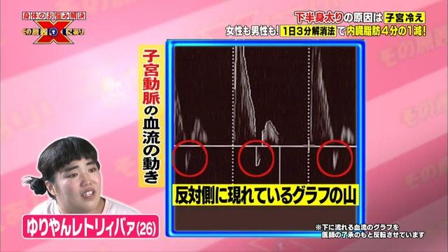 甚至，吉田小姐的血液有倒流情況出現。（圖／翻攝自節目「健康就要X」）