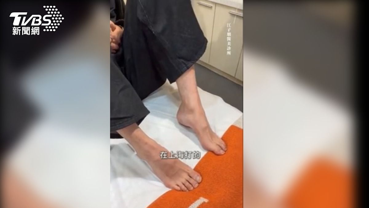 有民眾到上海醫美，為了長高在腳後跟打玻尿酸，但施打完３天卻痛到無法走。（圖／江子朋醫師提供）