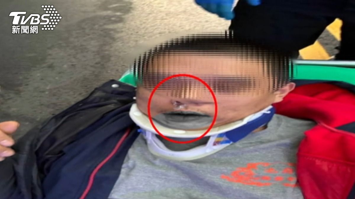 男騎士在淡江大學校門口旁自摔，神智不清，口鼻還沾白粉，原來是毒駕。（圖／TVBS）