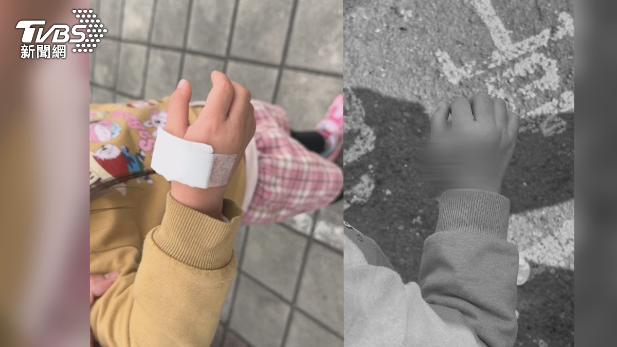 4歲女童逛花市被柴犬咬！母控攤商態度差，飼主：索賠1萬太多。（圖／TVBS）