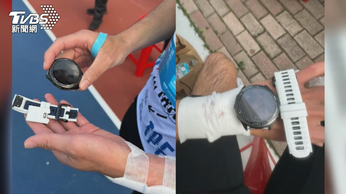 國內馬拉松好手顧紘慈，因為場地設計不良慘摔在地，不僅手錶噴飛，手腕、肩膀和膝蓋，通通都破皮擦傷。（圖／TVBS）