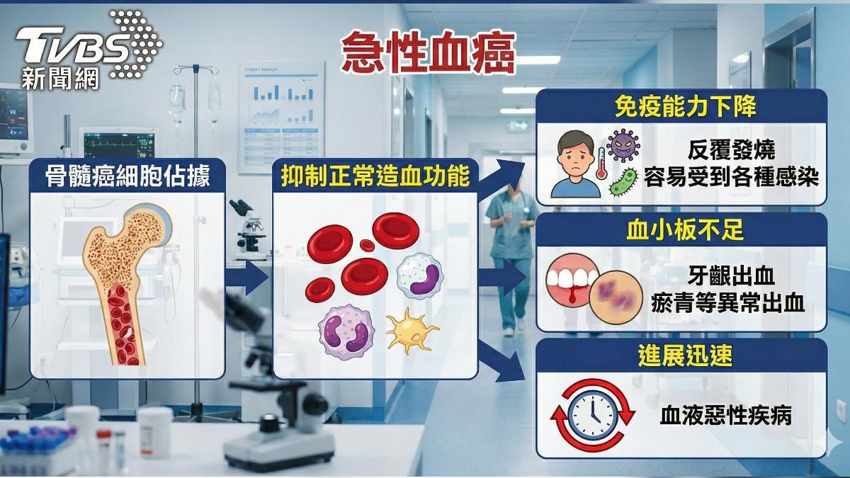 反覆發燒.瘀青.出血 醫師:恐急性血癌警訊 (圖/TVBS)