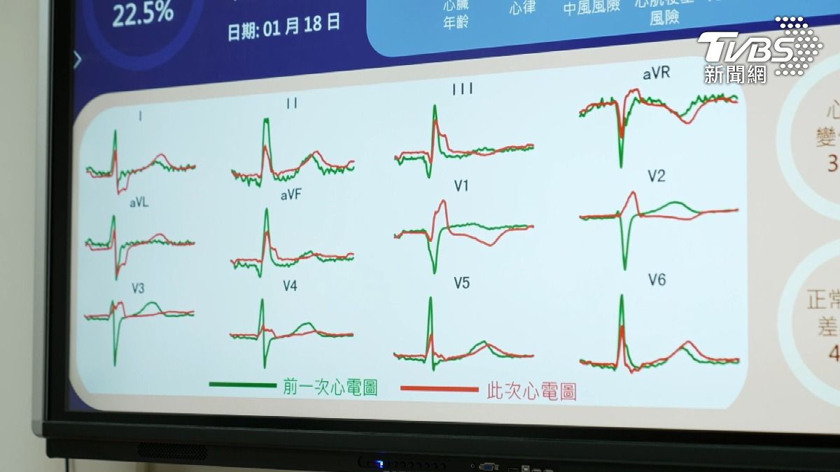 別只量血壓！醫師：「這類型人」必做「三項檢查」降低猝死風險！(圖/TVBS)