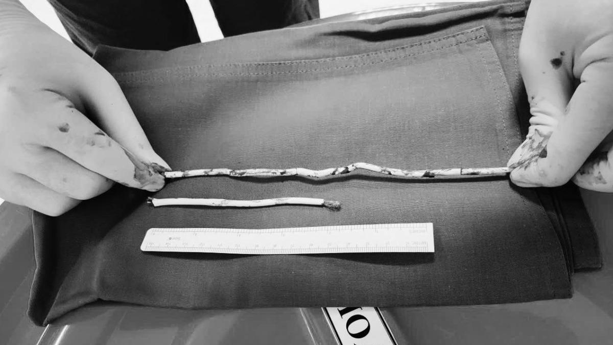 15歲少年「拿35cm網路線塞尿道」 醫緊急切開取出