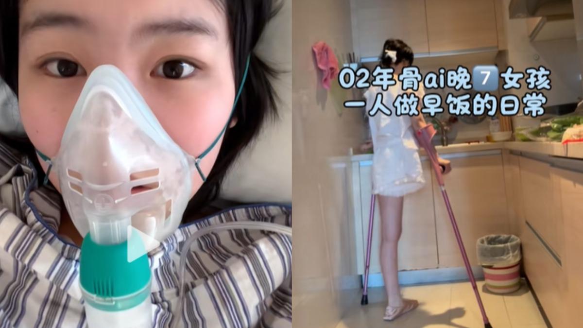 媽媽嫌她拖累!陸23歲網紅骨癌截肢遭父母拋棄 獨自挺6次手術