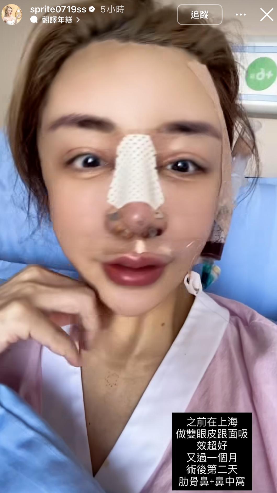 雪碧到上海整形。（圖／翻攝自雪碧IG）