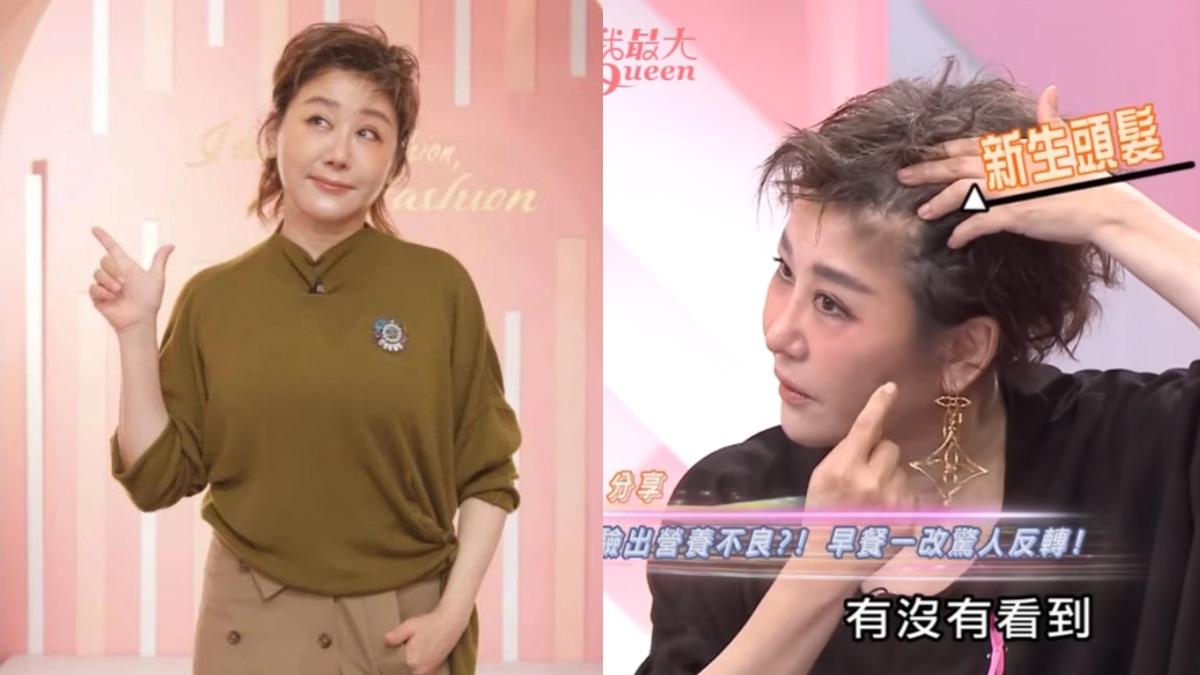 藍心湄營養不良「毛髮稀疏」!一天要吃8顆蛋 本人洩健康狀態