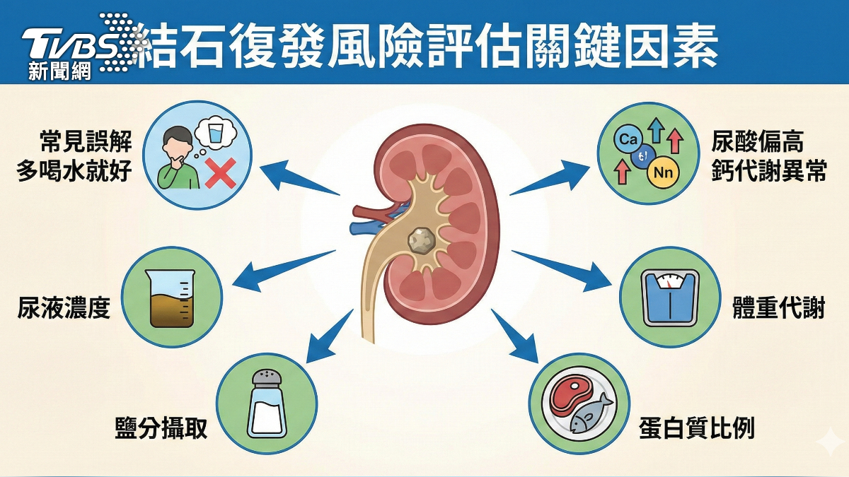 尿道結石恐敗血症 醫師示警:尿不出速就醫! (圖/蔣志偉)