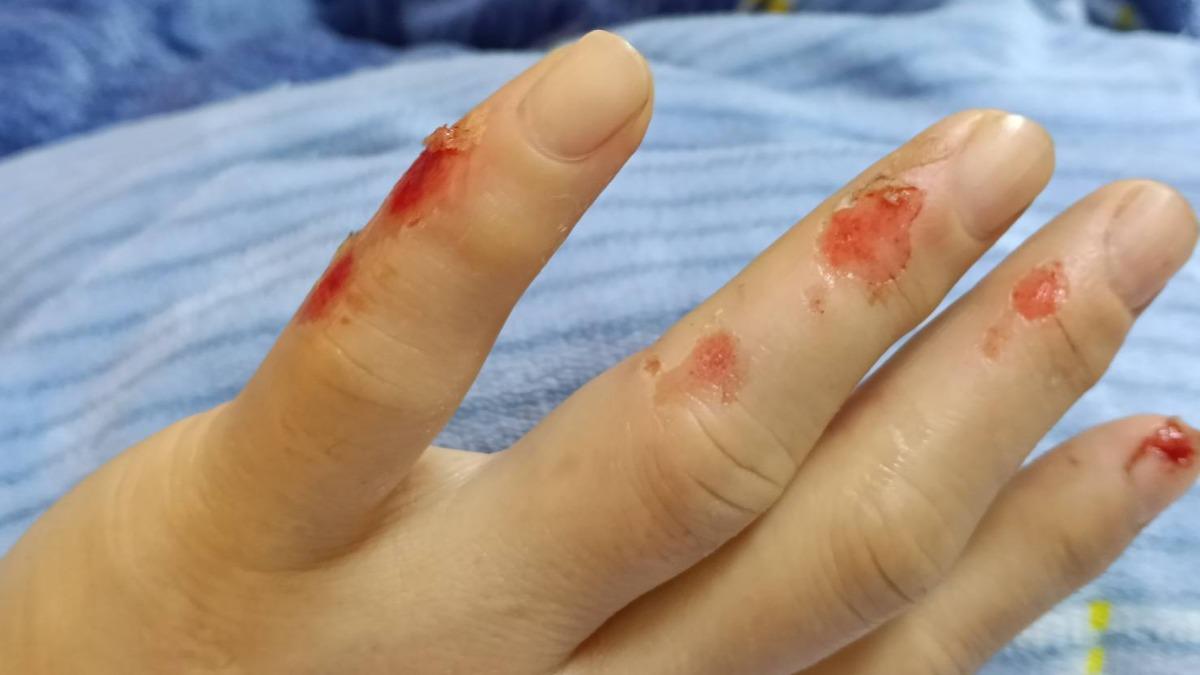 行經移山路遇猴群 女騎士反應不及自摔。(圖/蘇澳分局)