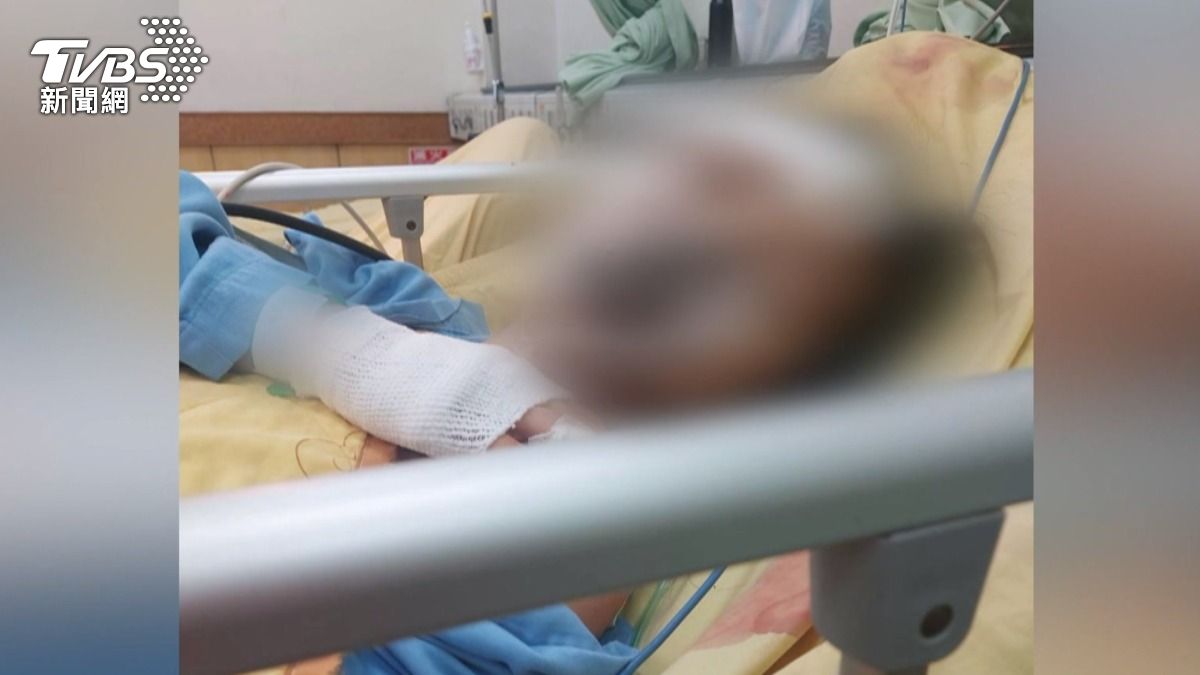 一名23歲女大生,機車突然撞上防撞桿後噴飛,送醫後至今仍昏迷不醒。(圖/TVBS)