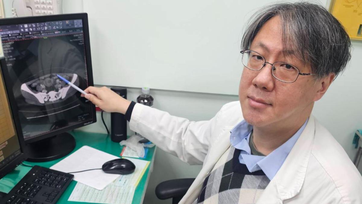 王志浩說明,「Vanek腫瘤」雖然罕見且屬良性,但因生長位置與特性,常會引發嚴重的腸套疊。(圖/澄清醫院平等院區提供)