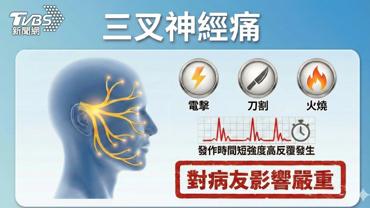 洗臉.刷牙像電擊痛 醫師:三叉神經痛勿拖延! (圖/TVBS)