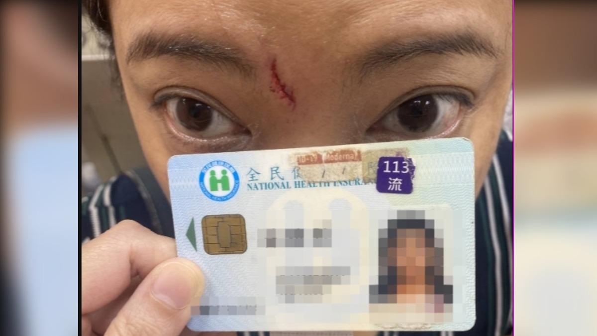 林女眉間傷口痊癒仍留疤,至少需做12次雷射。(圖/民眾提供)