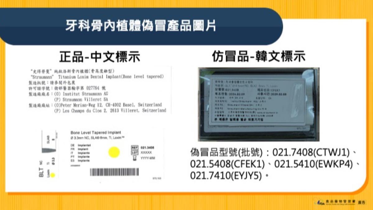 牙科骨內植體疑似仿品批號和標示。(圖/食藥署提供)