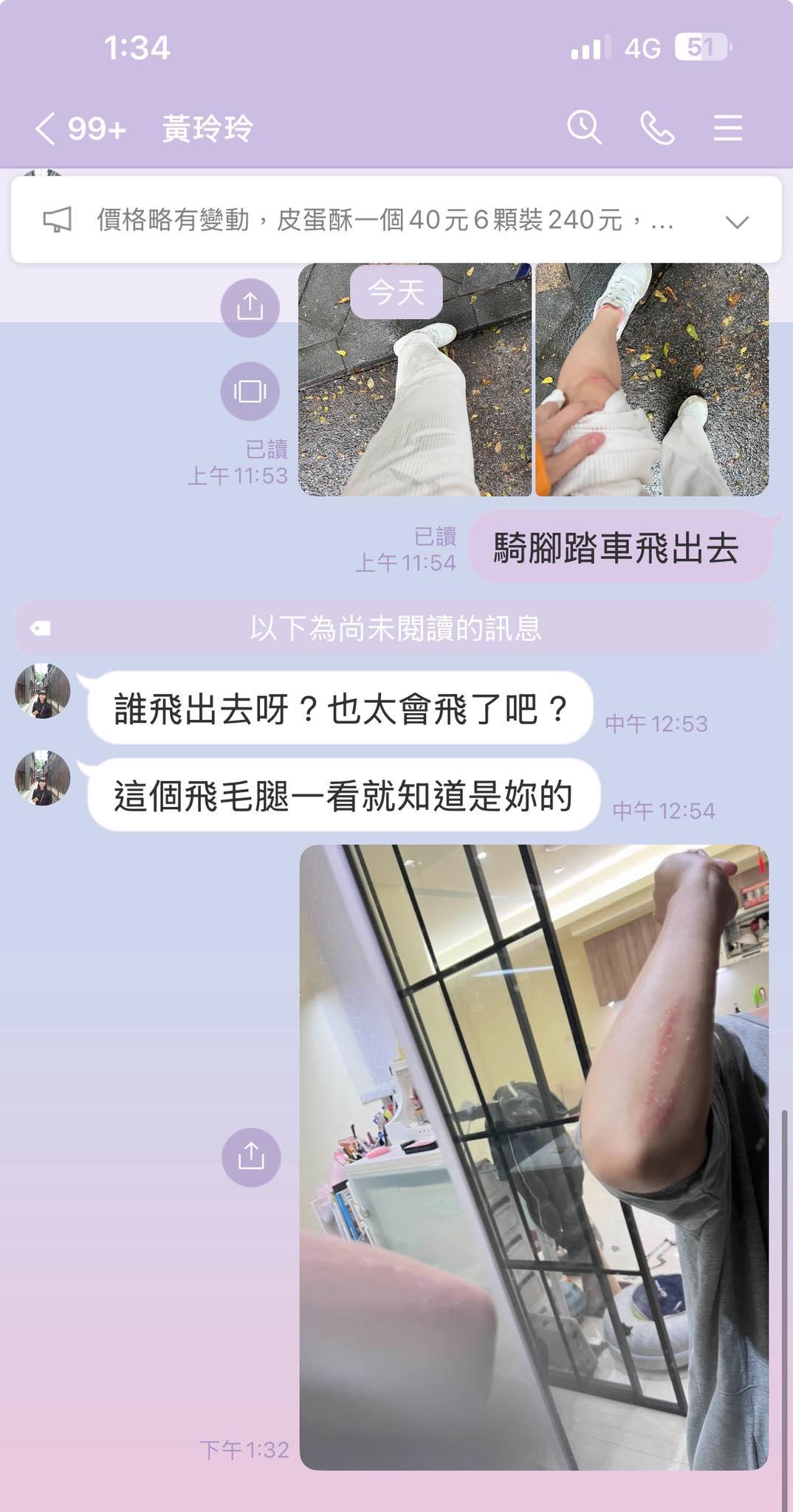 米可白車禍,女星車禍,八點檔女神車禍,本土劇女神車禍,米可白,米可白自摔,米可白重摔