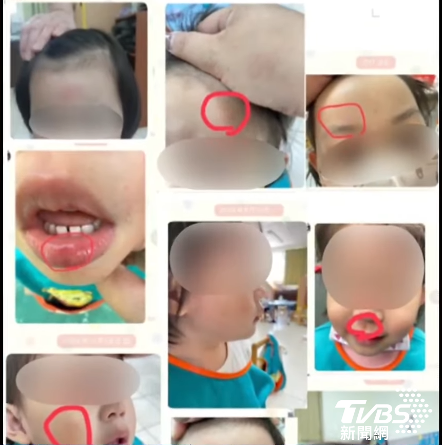 育全幼兒園,育全幼兒園虐待,育全幼兒園虐童,新北幼兒園虐待,新北幼兒園虐童,教保員虐童,教育局