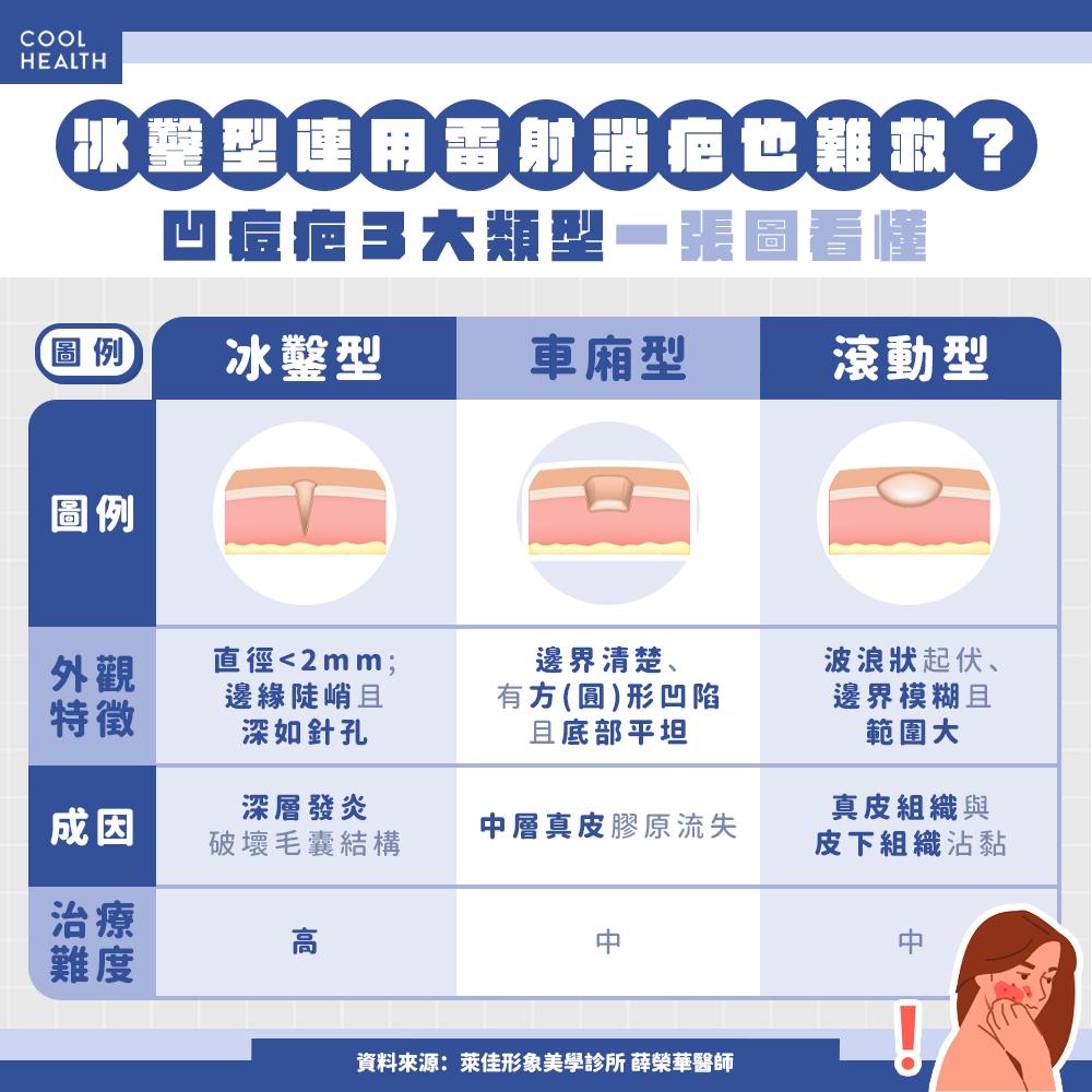 痘疤分為冰鑿、廂車及滾動三種型態，其中冰鑿型深及真皮層難度最高。（圖／潮健康）