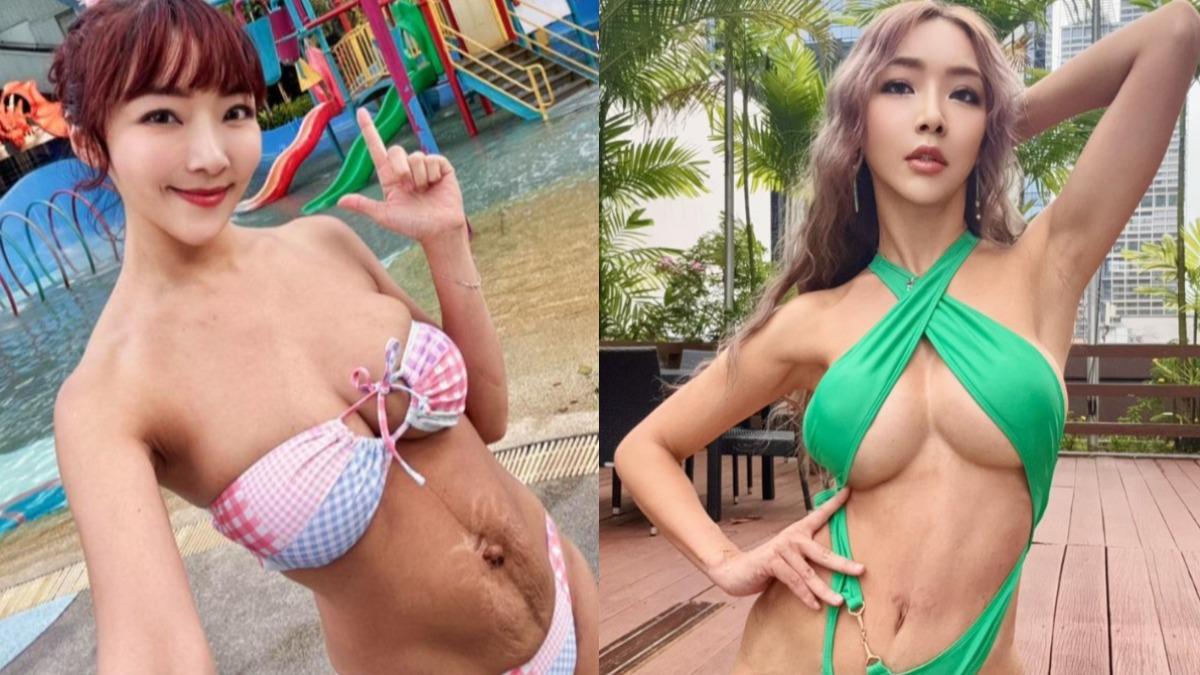 資生堂千金狂生5胎!產後「滿滿妊娠紋」遭羞辱 動4手術曬驚人美體