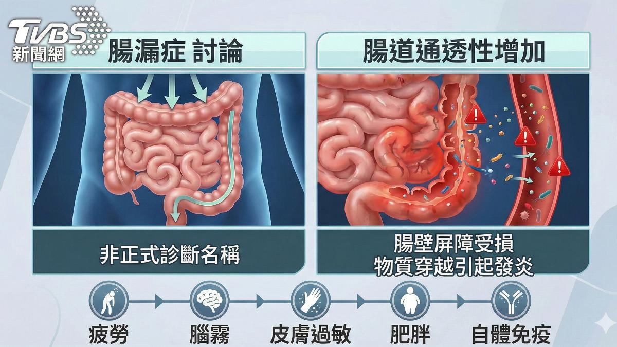 醫師:改變飲食.生活習慣 打造健康腸道屏障!