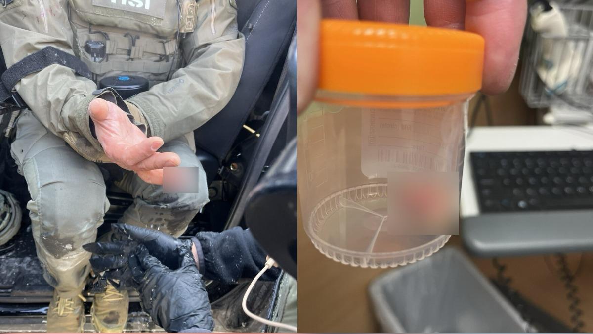 明州抗議升級！示威者咬掉探員手指　川普竟轉貼斷指爆血畫面