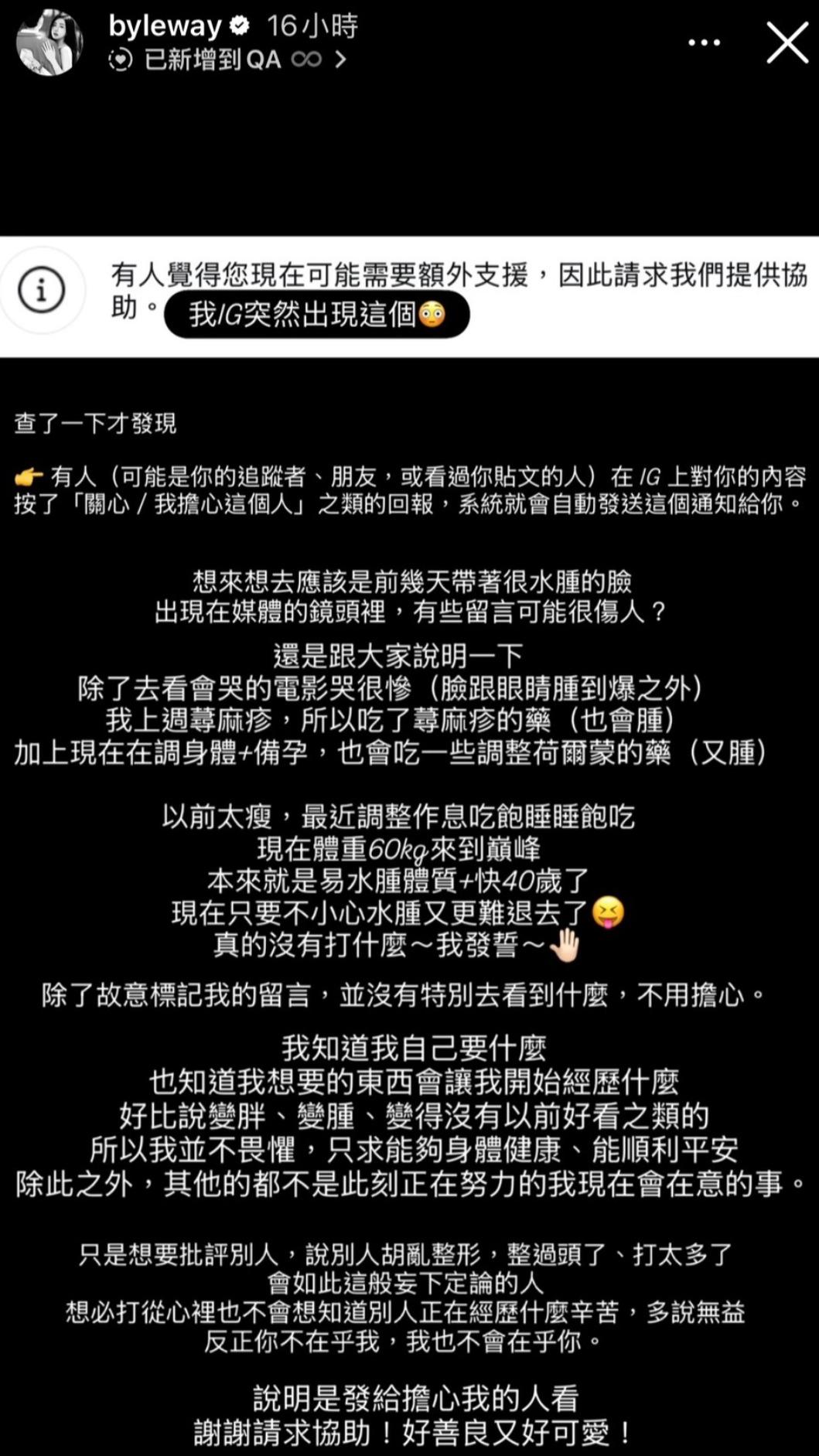 許允樂回應臉腫的原因。(圖/翻攝許允樂IG)