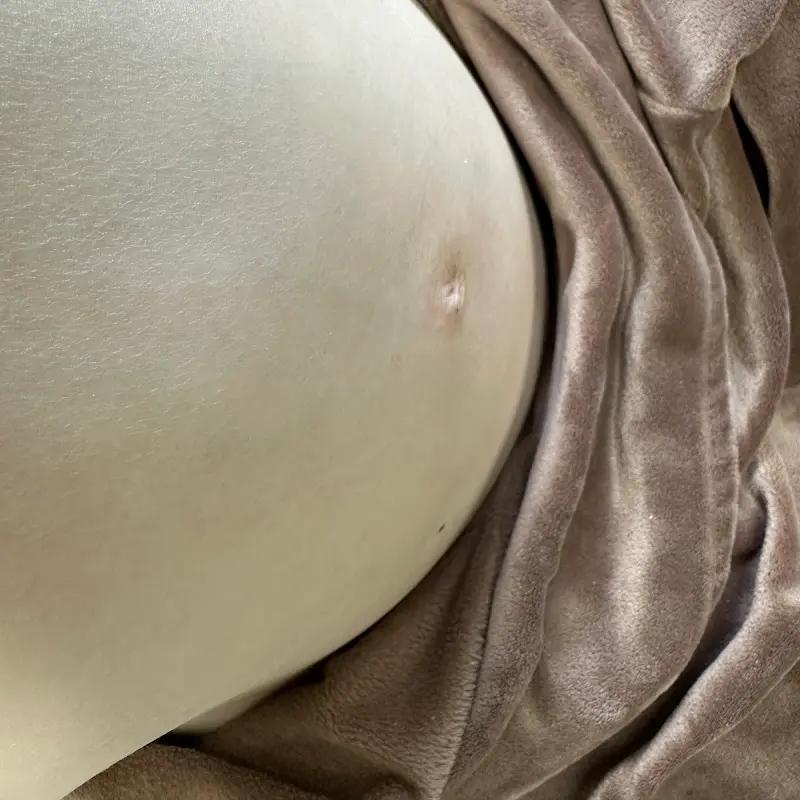 去年5月曾出現肺部積水等現象,但有病長壽Girl也撐過來了。(圖/翻攝自유병장수girl YouTube)