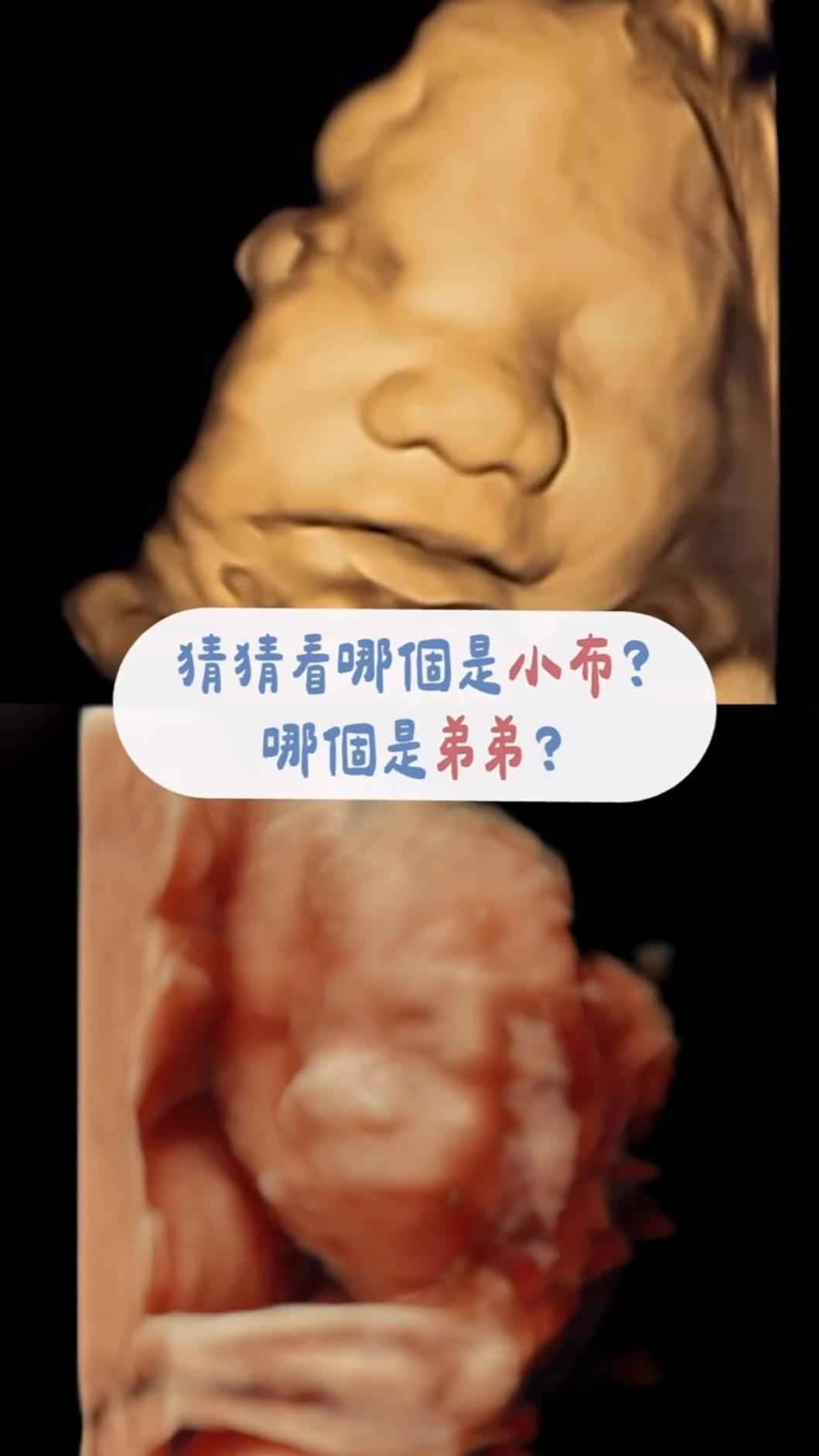 大寶「小布」與二寶輪廓十分相似,幾乎都遺傳爸爸。(圖/翻攝自Instagram/uccu0323)