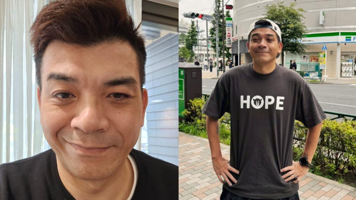 48歲史丹利「半邊臉麻痺」！病毒感染　嘴歪眼斜證實病況