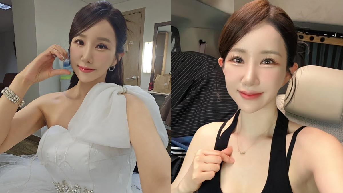 錄影途中頭炸痛！美魔女歌手「緊急送醫開刀」　驚人病因曝光了