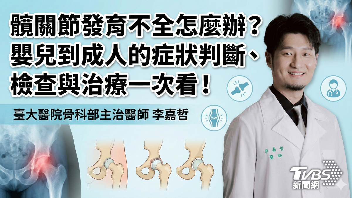 髖關節發育不全怎麼辦?嬰兒到成人的症狀判斷、檢查與治療一次看!