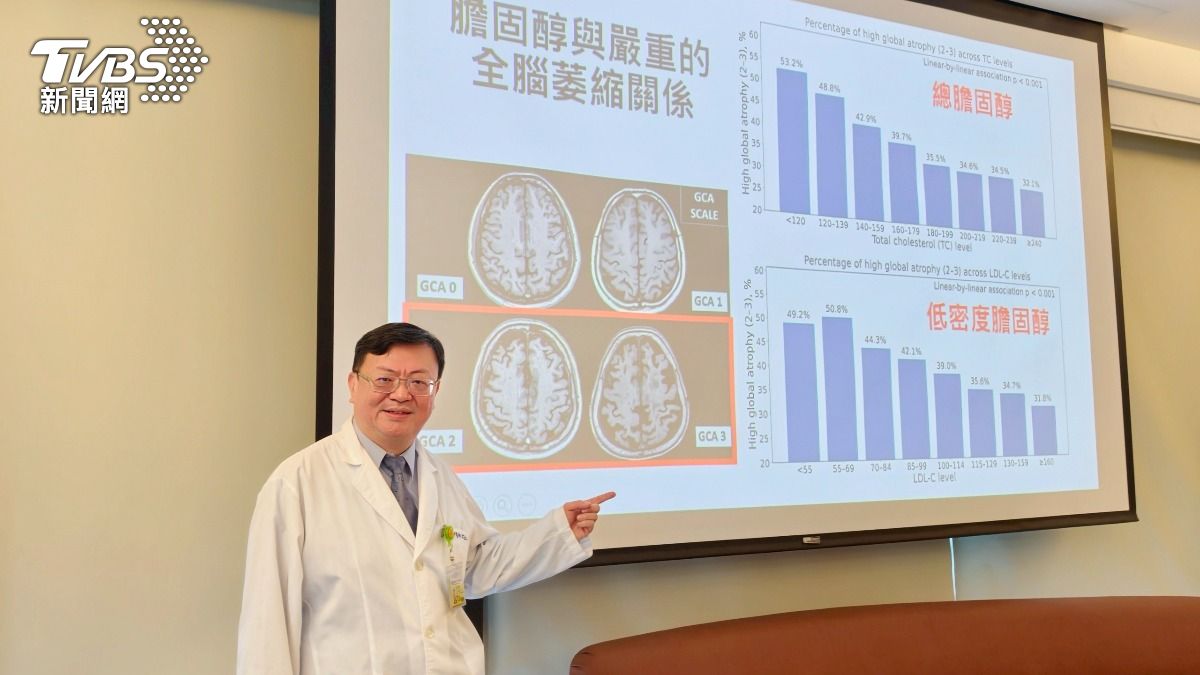 膽固醇降太快恐傷腦? 台灣研究揭高齡失智新警訊