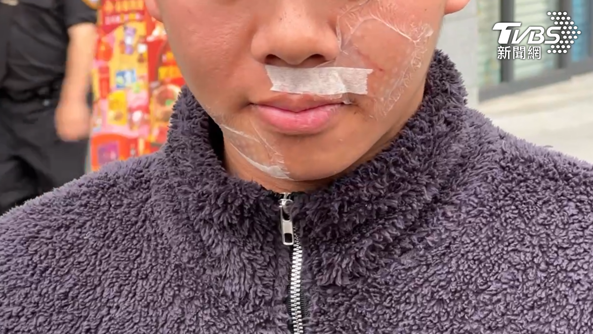 這名英勇的男大生，他是就讀台中某大學的高雄人簡同學，下車見義勇為上前勸阻，但臉、手、膝蓋都被馬姓男子抓到受傷（圖／TVBS）