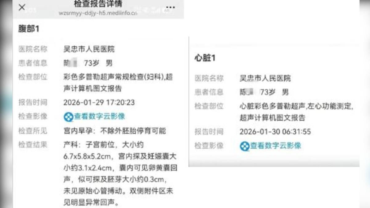 醫院報告竟顯示老翁有「宮內早孕」。（圖／翻攝微博@觀察者網）