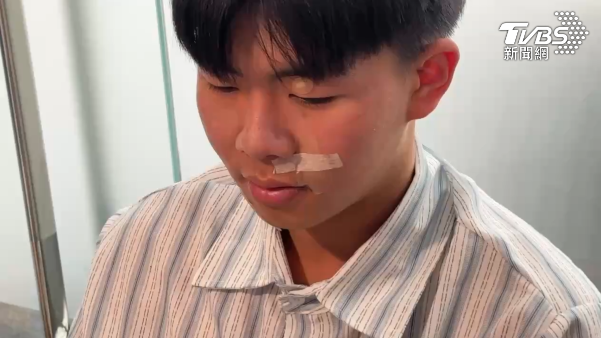 英勇救人的簡姓男大生,手上和膝蓋的挫傷破皮,已經好了大半,但臉上仍然貼滿OK蹦,這是屬於他的「榮耀勳章」(圖/TVBS)
