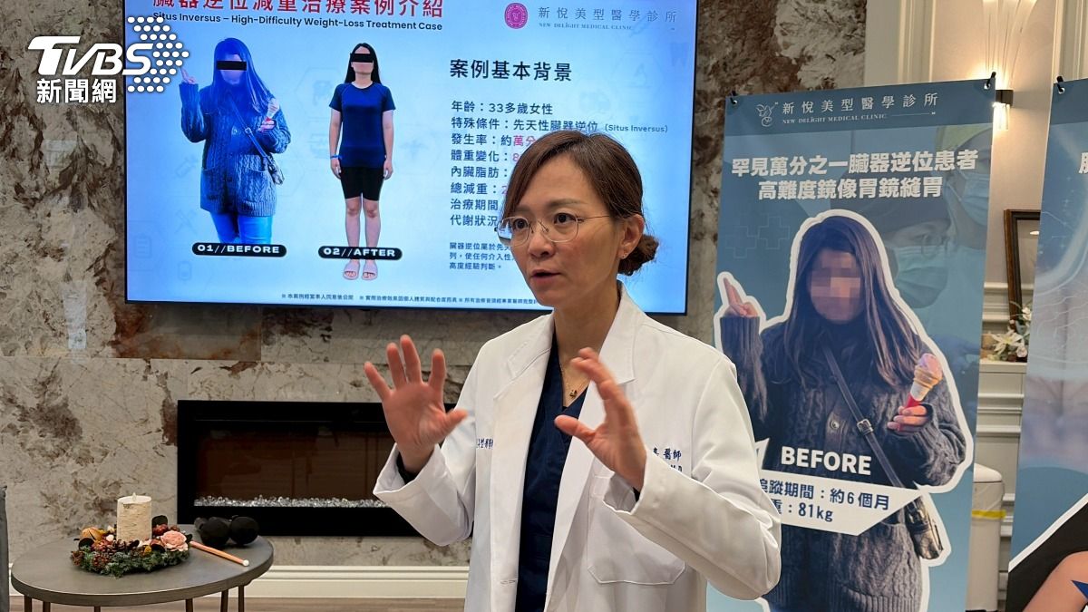 劉家嘉診斷，決定替二寶媽採取不切除器官、無體表傷口的胃鏡縫胃手術。（圖／林冠丞攝）