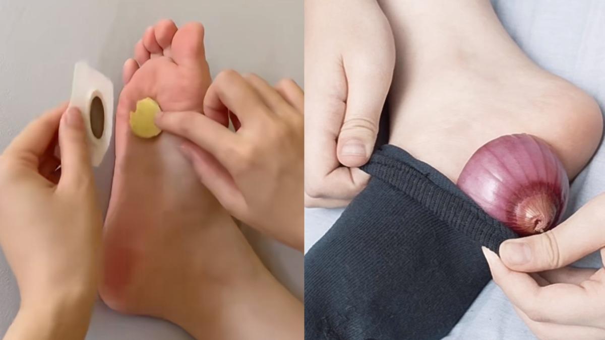 網瘋傳生薑、洋蔥敷腳祛濕法!中醫點「1體質」恐火上加油