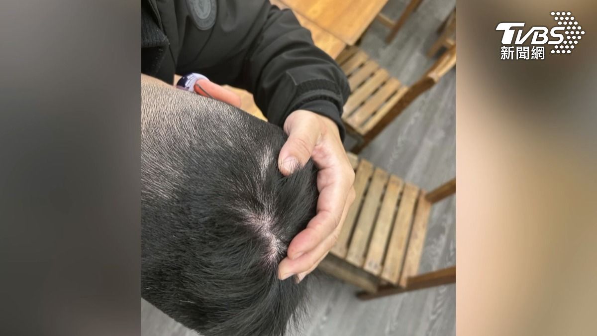 鴨肉店老闆表示，雖然沒有被戳傷，但對方拳拳都打在後腦勺，工作時也常常突然暈眩。（圖／店家提供）