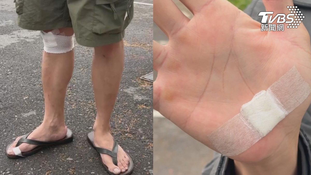 幸好救護車及時到場將人送醫,爸爸手掌、膝蓋都擦傷,而女孩的腳也腫了起來。(圖/TVBS)