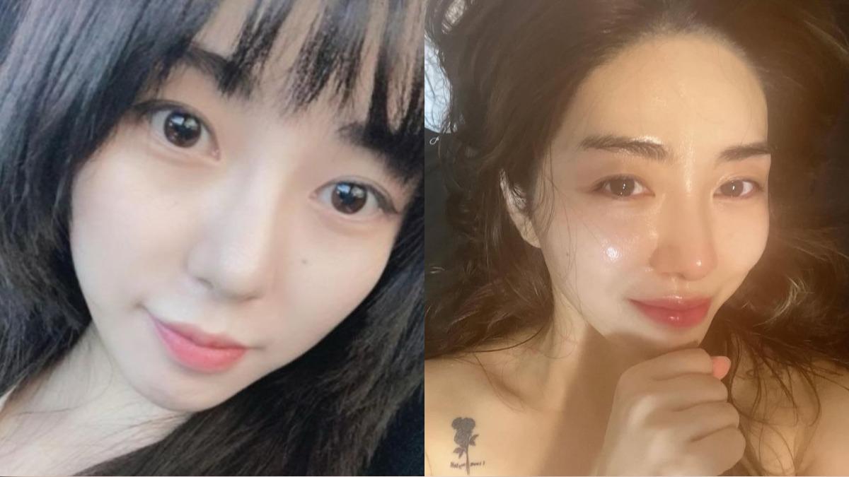 前AOA珉娥又遇衰事!打醫美慘毀容 皮膚二級燙傷「撕裂般疼痛」