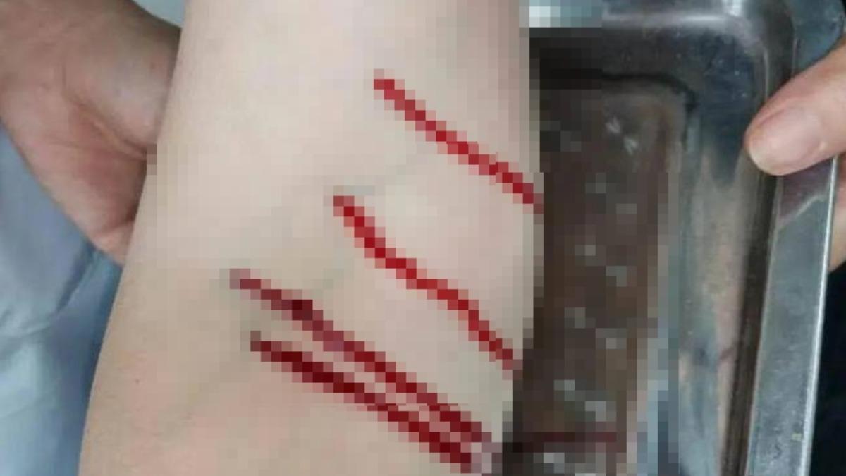 驚見滿地鮮血!陸無照醫「放血療法」稱排邪氣 網崩潰:在獻血嗎