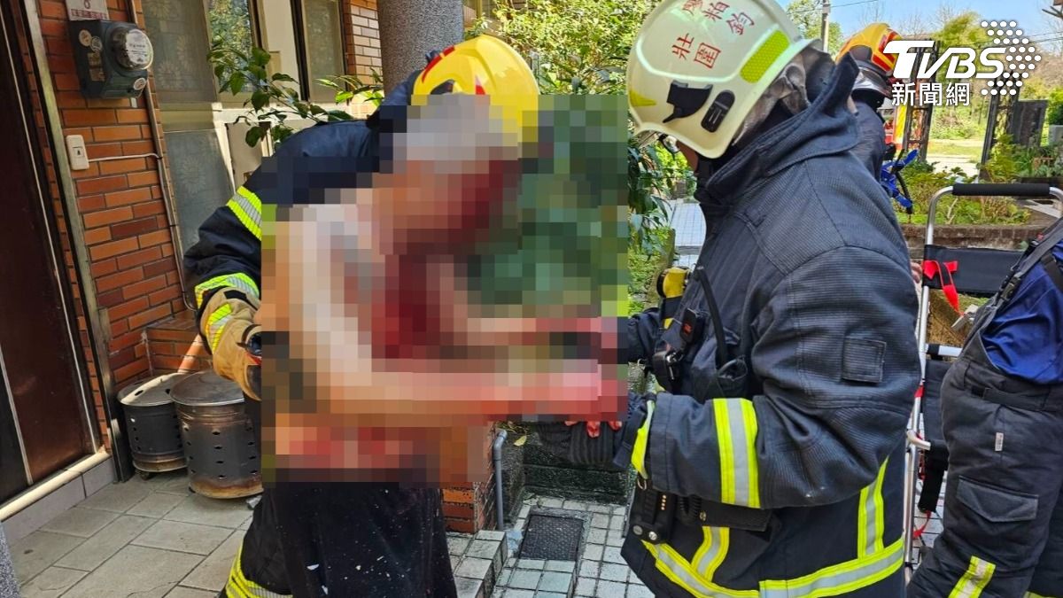 宜蘭包裹爆炸!爆「歹徒上門」送火藥 2姊弟全身血