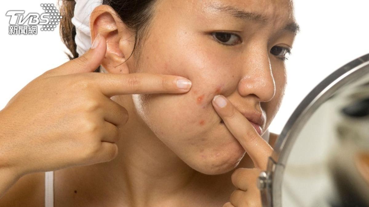 痘痘、掉髮有救了?網傳「補鋅」美容奇效 醫揭1吃法才有用