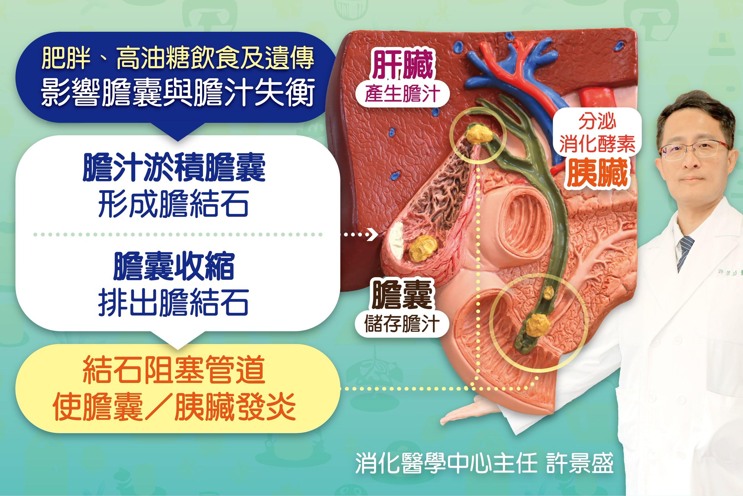 高風險食物若吃太多，容易導致膽汁淤積形成結石，進而引發膽囊與胰臟發炎。（圖／台中慈濟醫院提供）